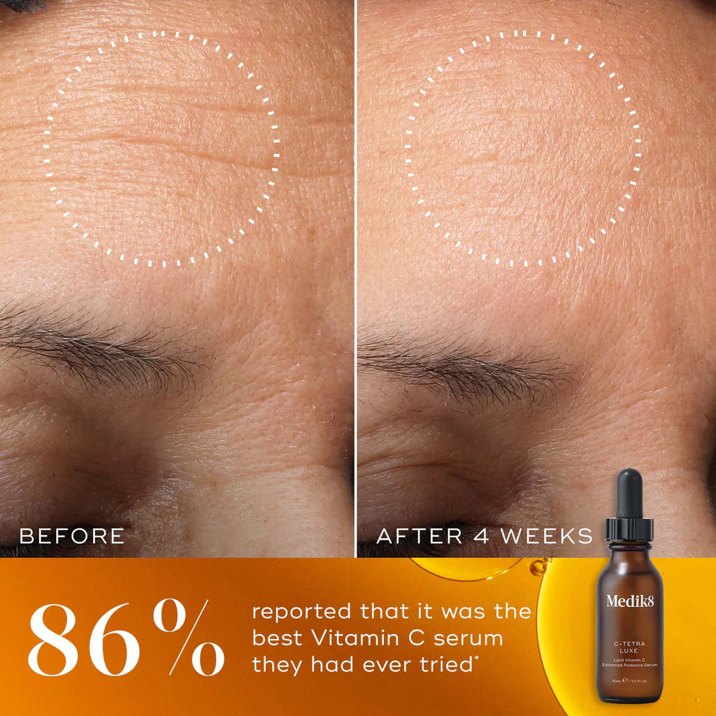 C-Tetra® Luxe - Lipid Vitamin C Enhanced Radiance Serum